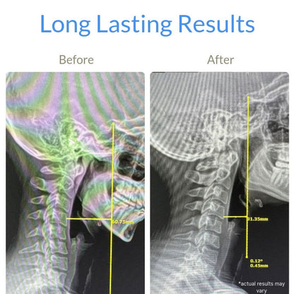 Vertex Cervical Care Device - Sokai LLC